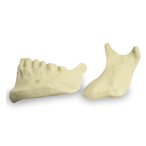 HEMI MANDÍBULA ESQUERDA COM CORTE DE OSTEOTOMIA SAGITAL - cód. 4029