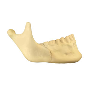 HEMI MANDÍBULA DIREITA COM CORTE DE OSTEOTOMIA SAGITAL - cód. 11976