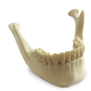 MANDÍBULA COM DENTES 38 E 48 INCLUSOS - cód. 12275