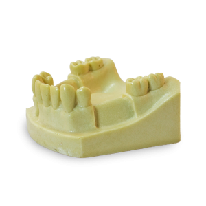 MANDÍBULA COM AUSÊNCIAS PARCIAIS - DENTES 35, 36, 42, 45 e 46 - cód. 4703