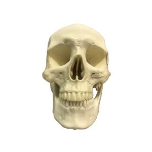 CRÂNIO COM FRATURA ZIGOMÁTICA E BLOCO DE APOIO - cód. 10985