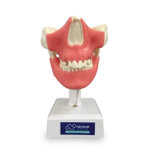 MANEQUIM COM DENTES INCLUSOS E GENGIVA - DENTES 13, 23, 18, 28, 38 E 48 - cód. 11491GT