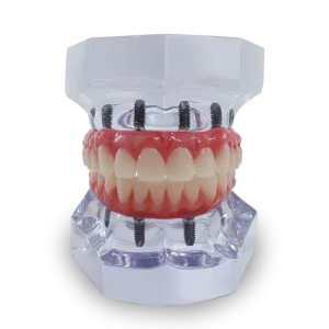 KIT DE PROTOCOLOS SUPERIOR E INFERIOR - cód. 11988