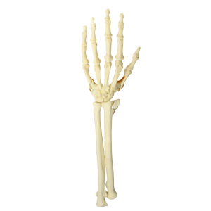 PUNHO - FRATURA 1 - ESQUERDO - cód. 9705