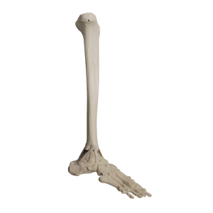 TORNOZELO - DIREITO - cód. 2031 PI