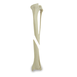 TÍBIA ESQUERDA COM FRATURA DISTAL - CÃO GRANDE PORTE - cód. AV260 ESPF2